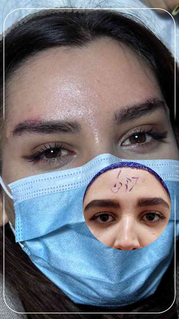 دو هفته بعد از دایرکت ابرو