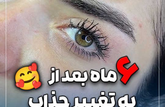 6 ماه بعد از یه تغییر جذاب