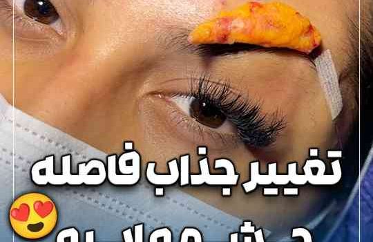 ابروهاشو به انتخاب خودش لیفت کردیم وحالت دادیم