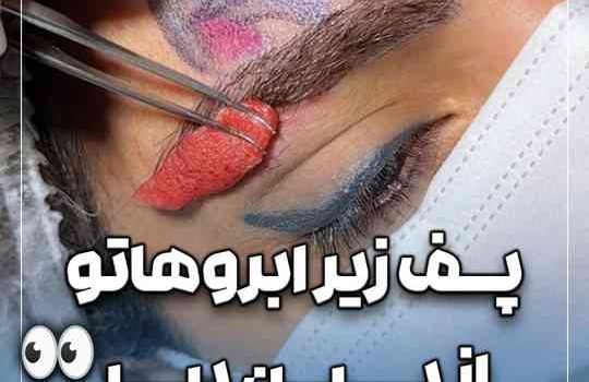 بهترین جایگزین بلفاروپلاستی