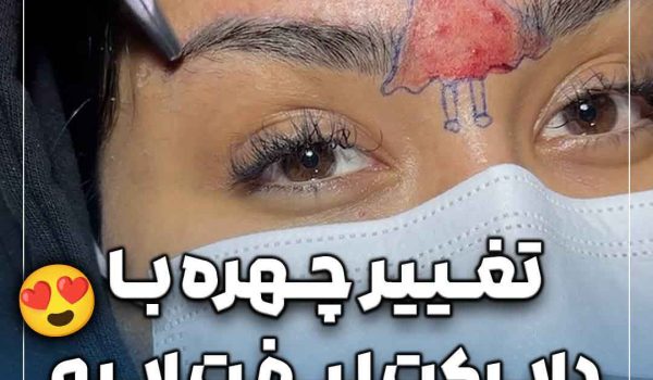 تغییر چهره با لیفت دایرکت ابرو