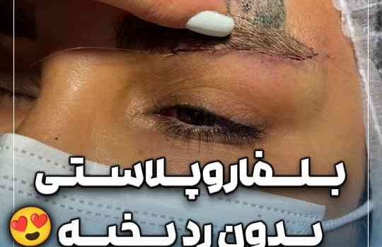 حذف پف ابرو بدون بخیه