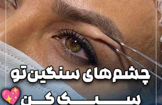 حذف پف چربی و پوست اضافه زیر ابرو