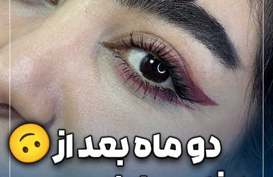 دو ماه بعد از بلفارو منشی مون