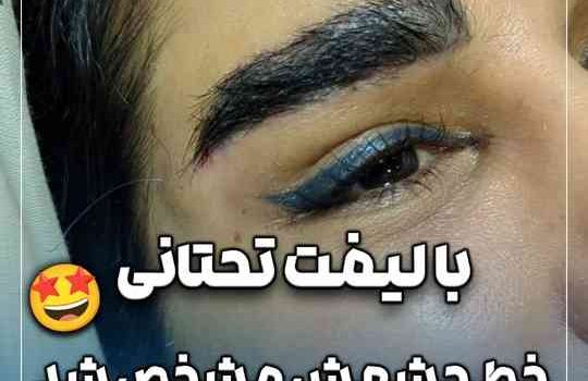 دو هفته بعد از لیفت تحتانی