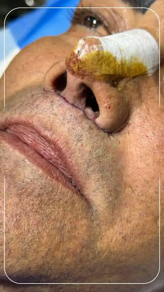 سانترال لب آقایان