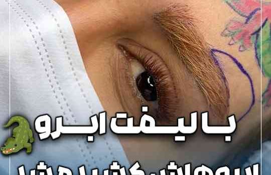 لیفت خاص هشت و دم ابرو