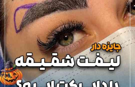 لیفت شقیقه با دایرکت ابرو