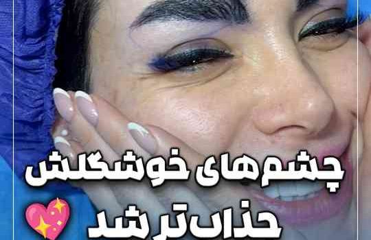 چشم های خوشگلش جذاب تر شد