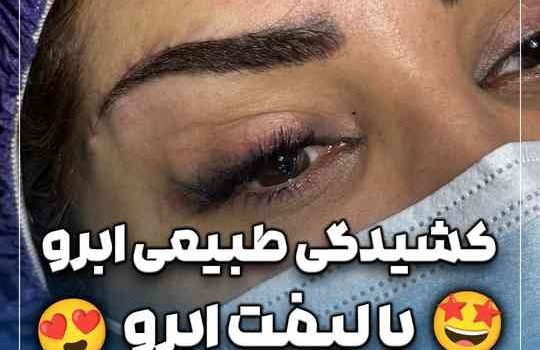 کشیدگی طبیعی ابرو با لیفت ابرو