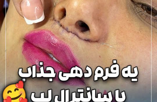 یه فرم دهی جذاب با سانترال لب