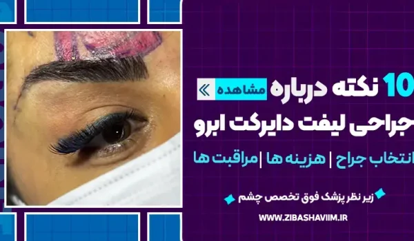 ۱۰ نکته درباره جراحی لیفت دایرکت ابرو؛ انتخاب جراح، هزینه و مراقبت‌ها