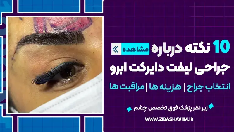 ۱۰ نکته درباره جراحی لیفت دایرکت ابرو؛ انتخاب جراح، هزینه و مراقبتها