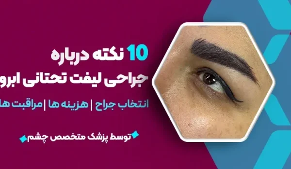 10 نکته درباره جراحی لیفت دایرکت تحتانی