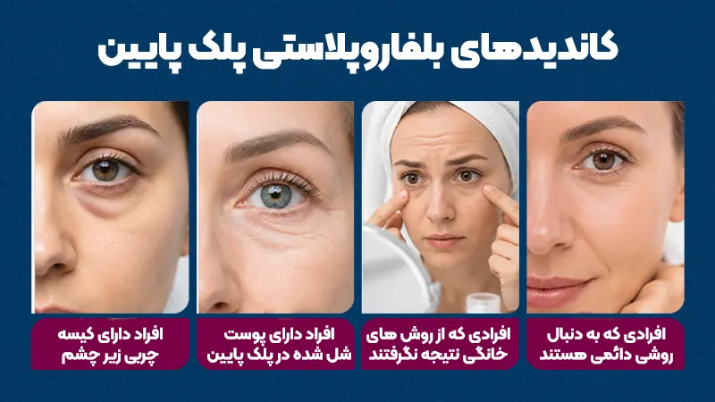 کاندیدهای بلفاروپلاستی پلک پایین