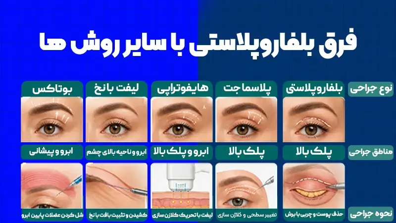 بلفاروپلاستی پلک بالا چیست و چه تفاوتی با سایر روشها دارد؟ 2 انواع روشهای بلفاروپلاستی پلک بالا