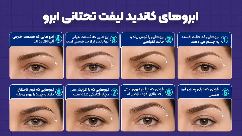 کاندید‌های لیفت تحتانی ابرو