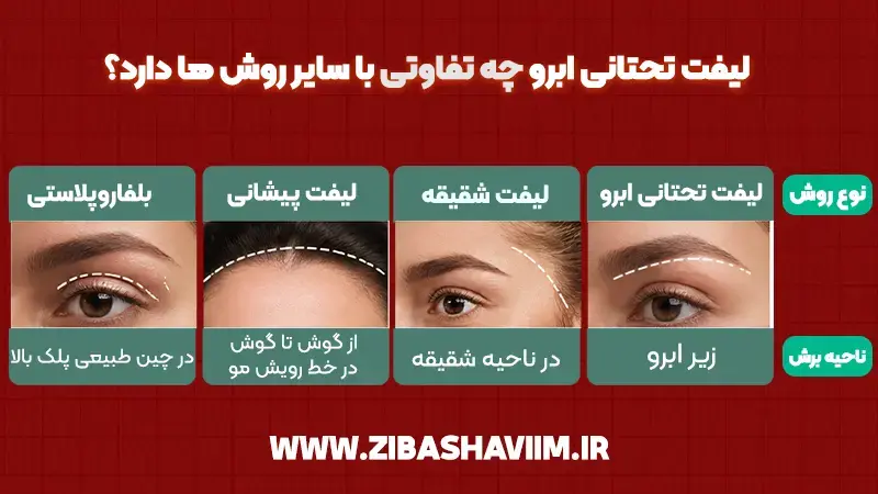 لیفت تحتانی ابرو چیست و چه تفاوتی با سایر روشها دارد؟ 2 لیفت تحتانی ابرو چیست؟