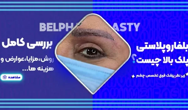 بلفاروپلاستی پلک بالا چیست؟ بررسی کامل روش، مزایا، عوارض و هزینه