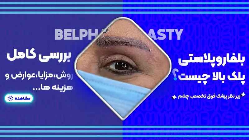 بلفاروپلاستی پلک بالا چیست؟ بررسی کامل روش، مزایا، عوارض و هزینه