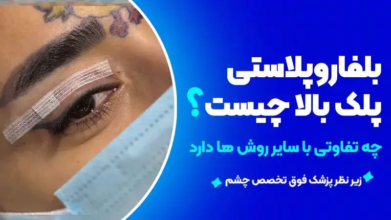 بلفاروپلاستی پلک بالا چیست و چه تفاوتی با سایر روشها دارد؟