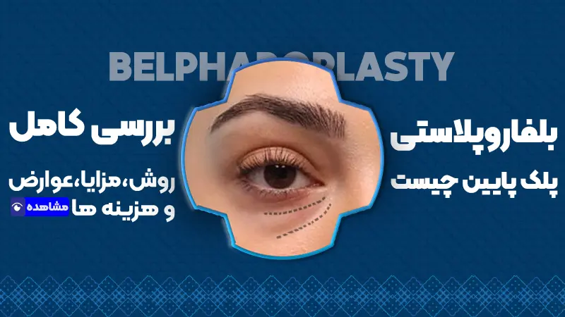 بلفاروپلاستی پلک پایین چیست؟ بررسی کامل روش، مزایا، عوارض و هزینه