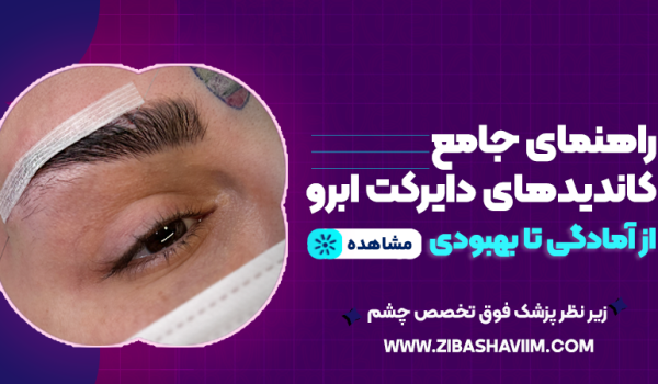 راهنمای جامع کاندیدهای دایرکت ابرو؛ از آمادگی تا بهبودی 1 راهنمای جامع کاندیدهای دایرکت ابرو