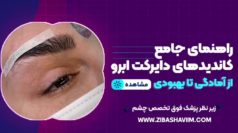راهنمای جامع کاندیدهای دایرکت ابرو