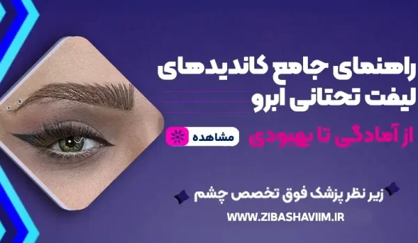 راهنمای جامع کاندیدهای لیفت تحتانی ابرو؛ از آمادگی تا بهبودی