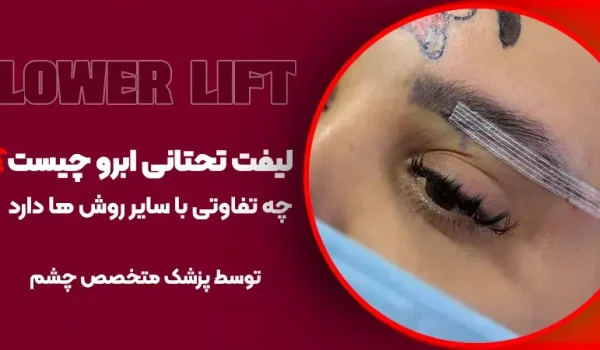 لیفت تحتانی ابرو چیست و چه تفاوتی با سایر روش‌ها دارد؟