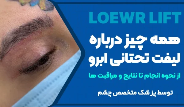 همه چیز درباره لیفت تحتانی ابرو؛ از نحوه انجام تا نتایج و مراقبت‌ها