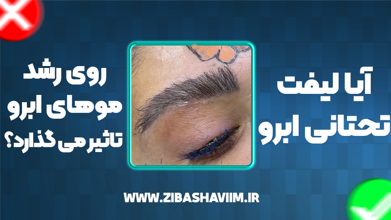 آیا لیفت تحتانی ابرو روی رشد موهای ابرو تاثیر میگذارد؟