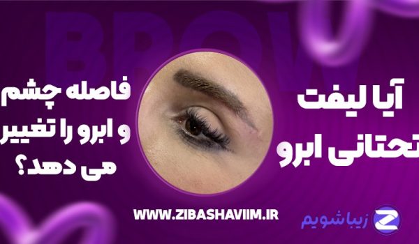 آیا لیفت تحتانی ابرو، فاصله چشم و ابرو را تغییر می‌دهد؟