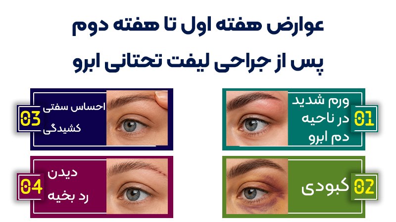 آیا لیفت تحتانی ابرو ارزش هزینه کردن دارد؟ 1 در چه موقعیتی لیفت تحتانی، ارزش انجام دارد؟