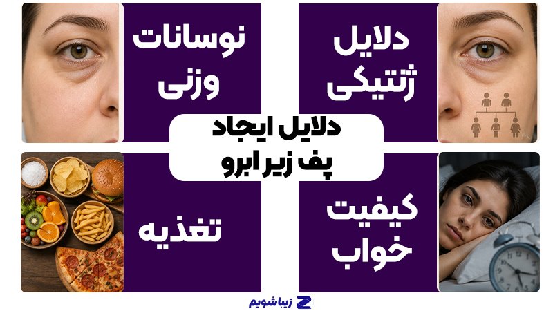 آیا لیفت تحتانی ابرو میتواند حالت خسته و غمگین چشمها را برطرف کند؟ 2 دلایل ایجاد پف و چربی زیر ابرو
