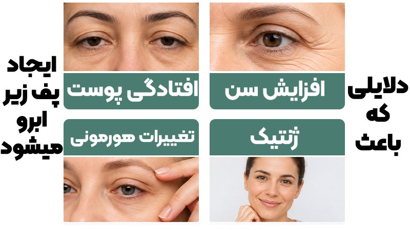 انواع روش‌های حذف پف زیر ابرو