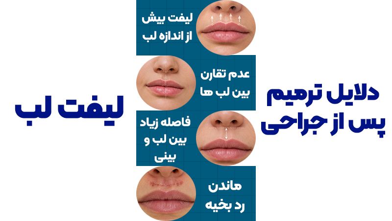 جراحی ترمیمی لیفت لب و بهترین زمان انجام آن 2 مراقبتهای پس از انجام لیفت لب و جراحی بینی همزمان