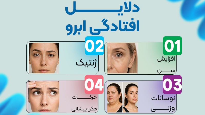 تغییر فاصله چشم و ابرو در جراحی لیفت ابرو؛ هر آنچه راجب افتادگی و حالت دادن به ابروها باید بدانید 1 دلایل افتادگی ابرو