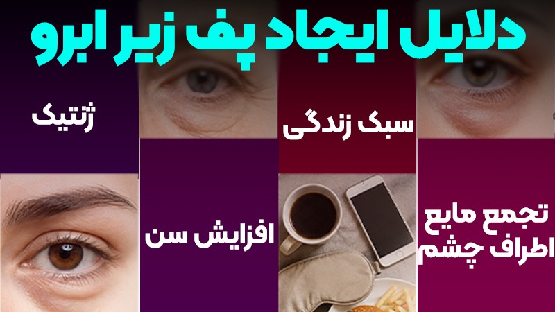 دلایل ایجاد پف زیر ابرو