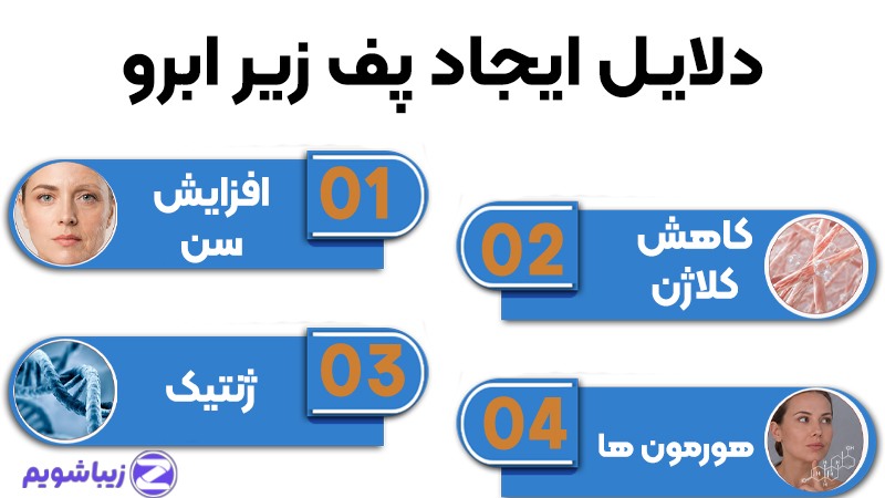 راهنمای انتخاب بین روشهای مختلف حذف پف زیر ابرو 2 دلایل ایجاد پف زیر ابرو