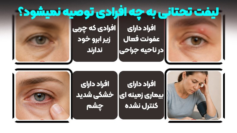 قبل از انتخاب لیفت تحتانی ابرو چه نکاتی را باید بدانیم؟ 2 قبل از انتخاب لیفت تحتانی ابرو چه نکاتی را باید بدانیم؟