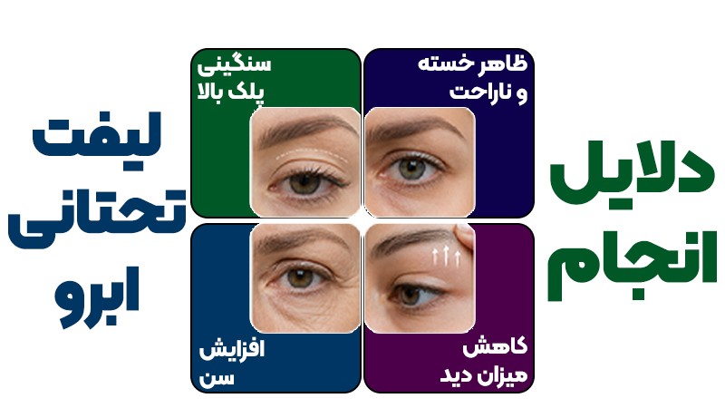 کاندیدهای لیفت تحتانی ابرو چه افرادی هستند؟ بررسی کامل فرم چشم و ابرو 2 دلایل انجام لیفت تحتانی ابرو