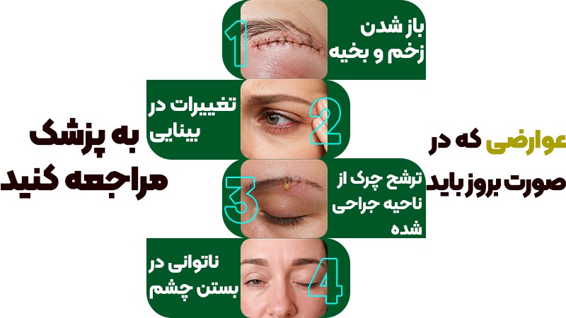 عوارض لیفت تحتانی ابرو چیست؟ بررسی ریسکها و راههای کاهش آن 3 زمان مراجعه به پزشک بعد از لیفت تحتانی ابرو