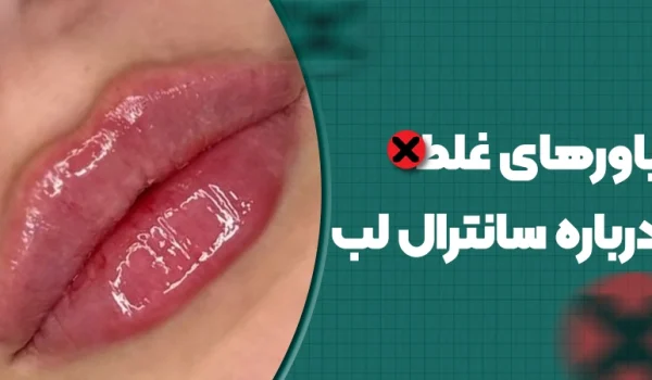 باورهای غلط درباره سانترال لب