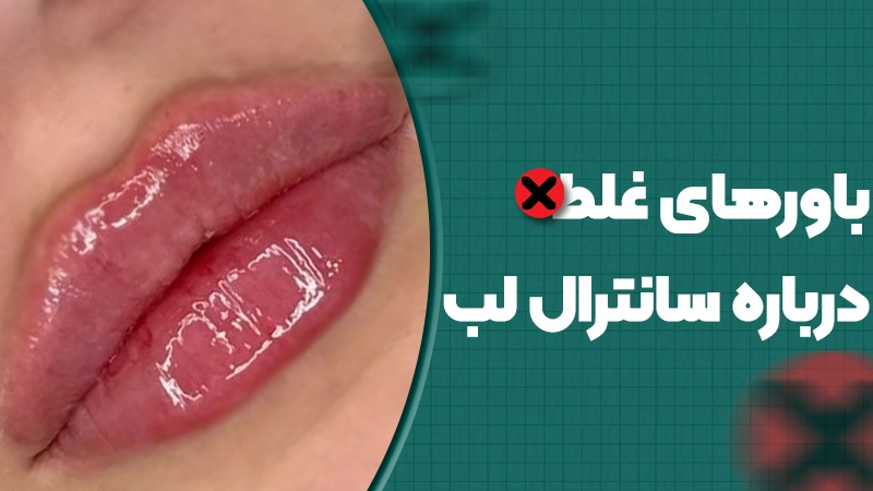 باورهای غلط درباره سانترال لب