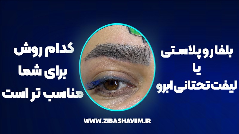 بلفاروپلاستی یا لیفت تحتانی ابرو؟ کدام روش زیبایی برای شما مناسبتر است؟