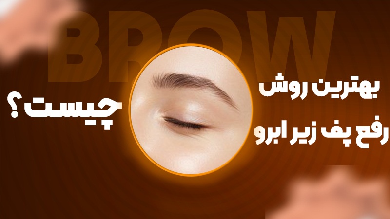 بهترین روش رفع پف زیر ابرو چیست؟