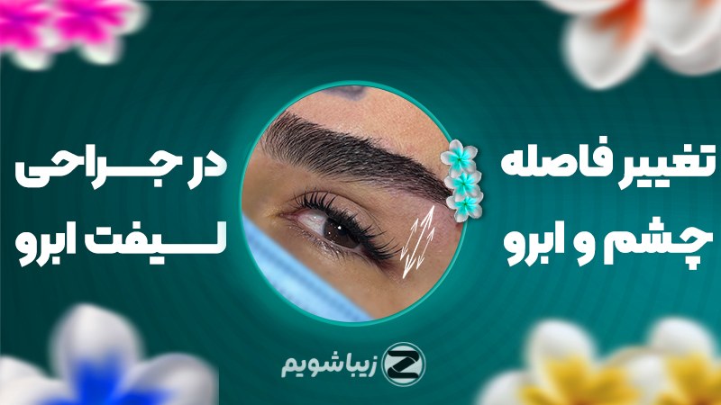 تغییر فاصله چشم و ابرو در جراحی لیفت ابرو؛ هر آنچه راجب افتادگی و حالت دادن به ابروها باید بدانید