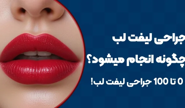 جراحی لیفت لب چگونه انجام می‌شود؟ صفر تا صد جراحی لیفت لب