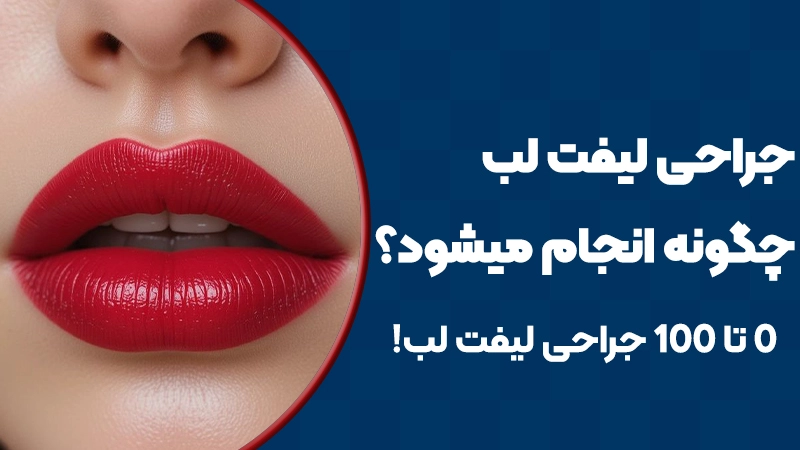 جراحی لیفت لب چگونه انجام میشود؟ صفر تا صد جراحی لیفت لب